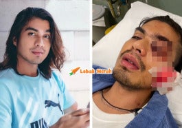 ben amir 1