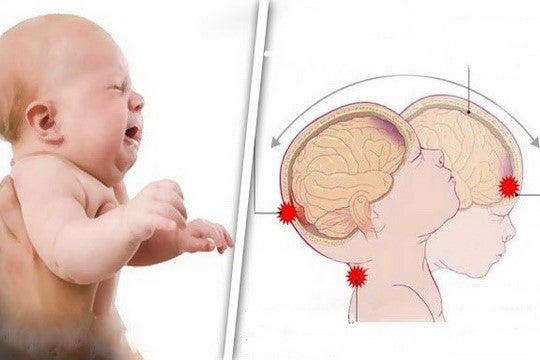 shakenbaby sindrome del bambino scosso 1