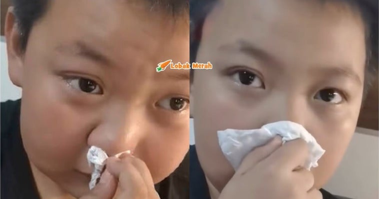 f2 book allergy