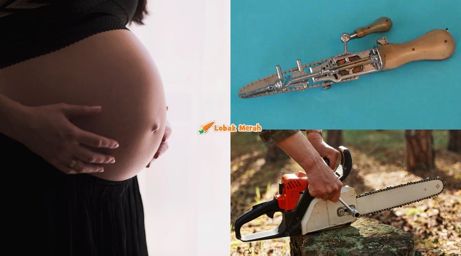 chainsaw bayi mengandung