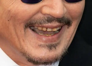 Gg