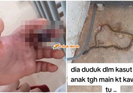 anak dipatuk ular jari membiru