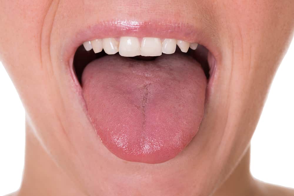 healthy tongue 1