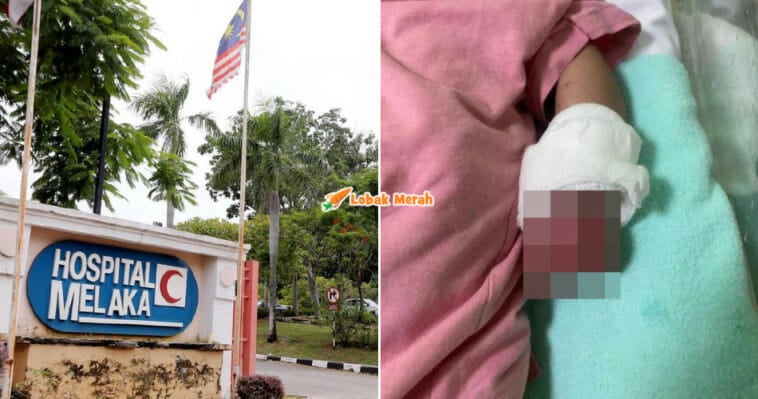 tangan bayi bengkak bernanah