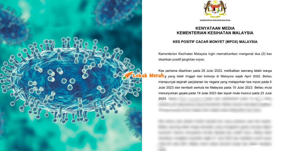 Mpox Malaysia