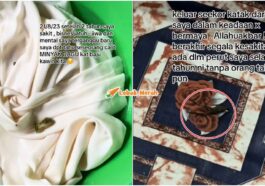 dicalit minyak dagu