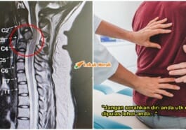 leher pulas doktor tegur buat konsultasi sebelum jumpa chiro