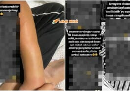 ft dktor bagi antibiotik