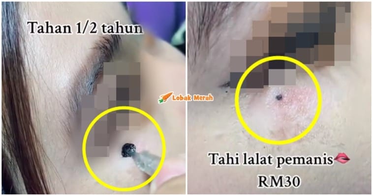 lalat 5