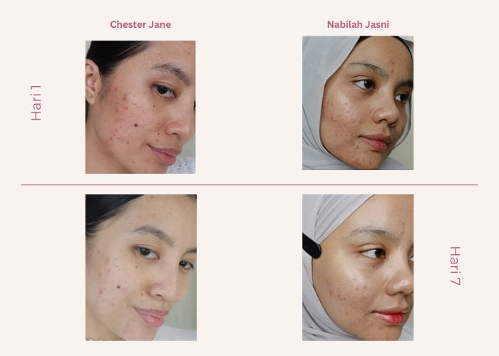 Pink Minimalist Beauty Skincare Before After Collage Instagram Post 1