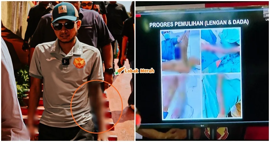 Progres Pemulihan Faisal Halim1