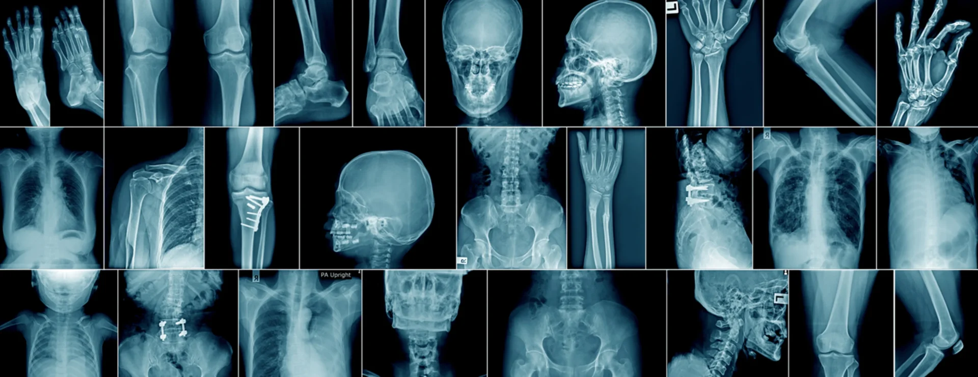 X Ray Skeleton