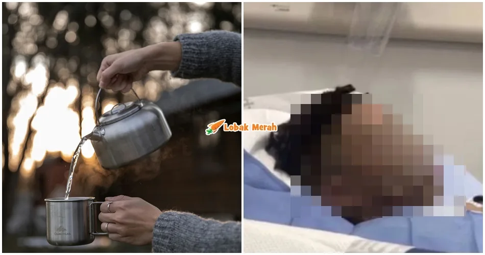 Gurauan Melampau, Anak Jiran S*mbah Air Panas Pada Budak Lelaki Ketika Sedang Tidur