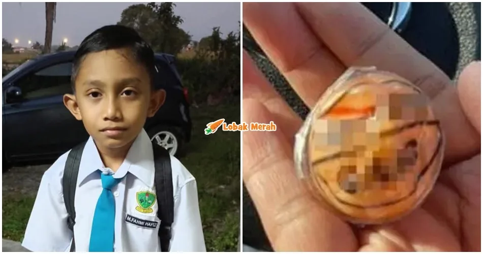 "Saya lihat air matanya bertakung menahan sakit" - Murid Tercekik Gula-gula 'Gummy' Sedang Tenat