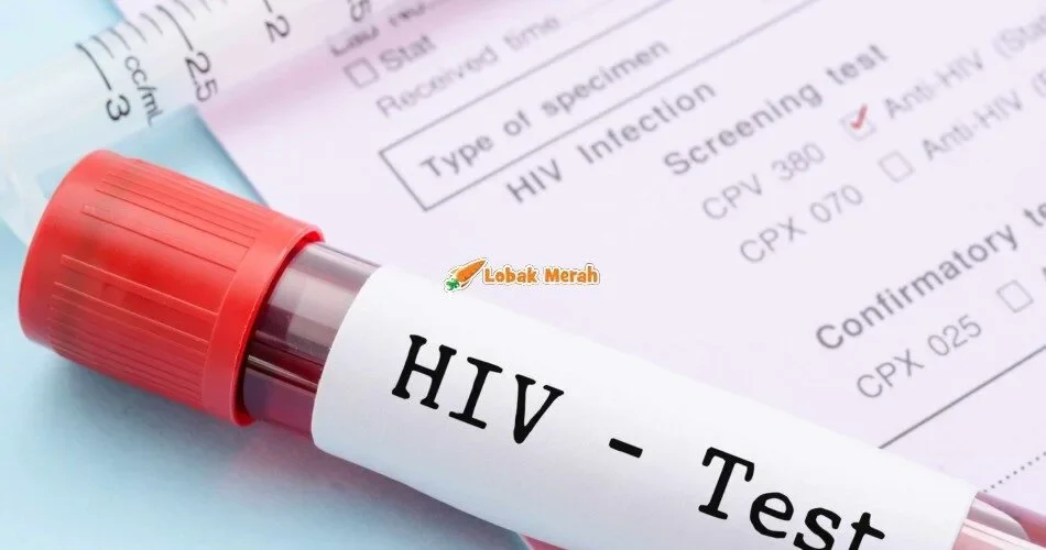 HIV