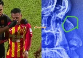 Faisal Halim alami kecederaan hidung