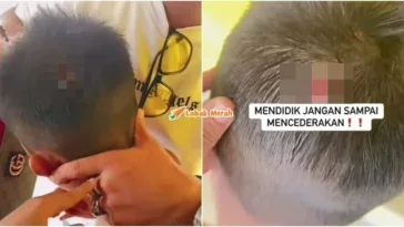 guru lempar kotan pensel kepala murid cedera