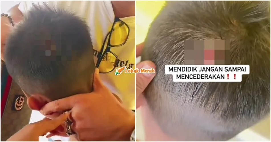 “Ni bukan cara nak didik” – Guru Didakwa Lempar Kotak Pensel Sebabkan Kepala Anak Murid Cedera