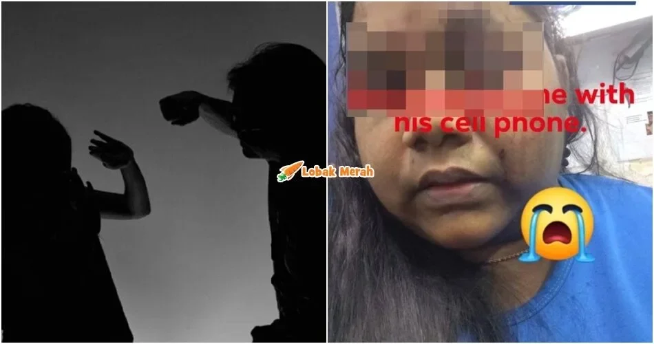 Isteri Cedera Dip*kul Suami Gara-gara Lawat Bapa Tanpa Kebenaran