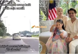 ryzal didik rina kecantikan warna kulit