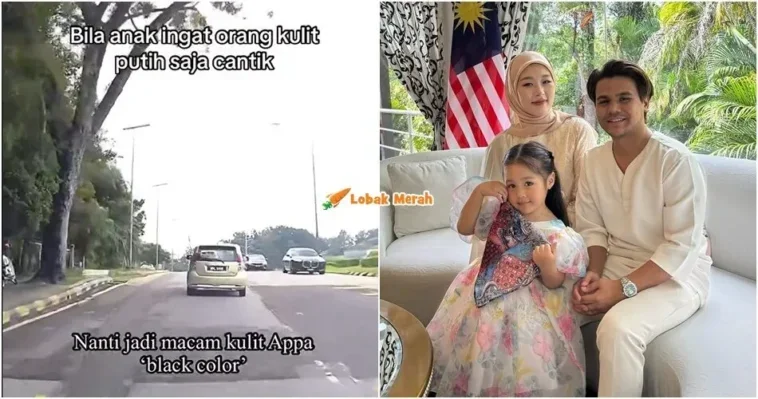 ryzal didik rina kecantikan warna kulit