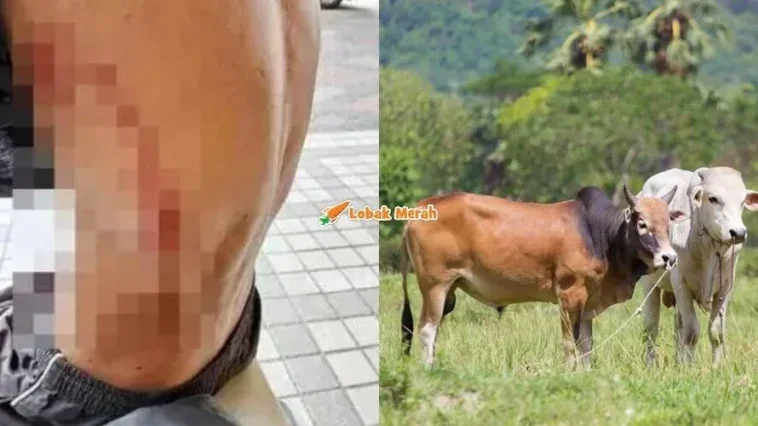Tulang Rusuk