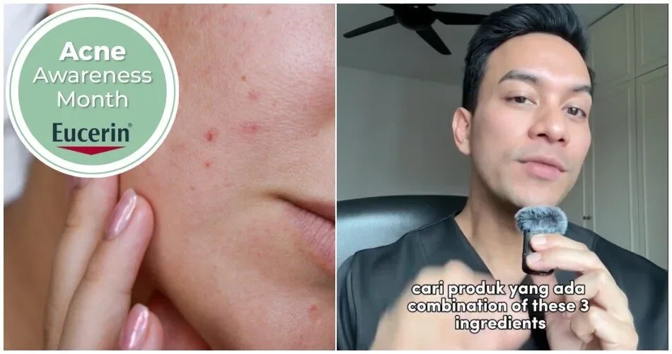 Bulan Kesedaran Jerawat: Pakar Kulit Jelaskan Punca Jerawat Tak Hilang Walaupun Dah Guna Banyak Produk