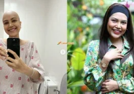 elyana kongsi foto berkepala botak di instagram