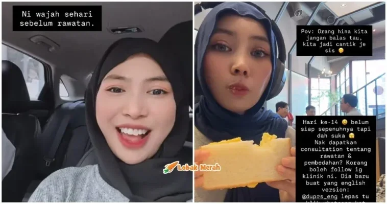 ft kim seri buat wajah baru