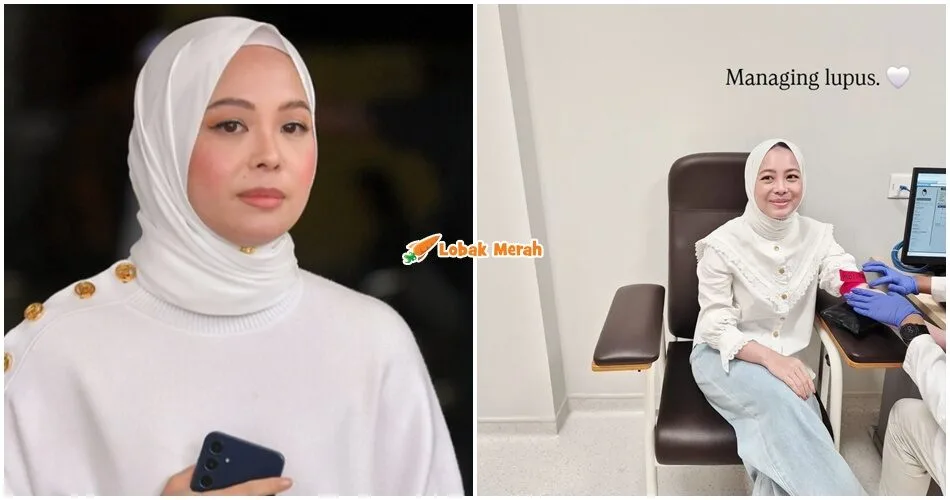 “Saya bersyukur” – Vivy Yusof Reda Hidap SLE, Tetap Usaha Untuk Mencari Rawatan