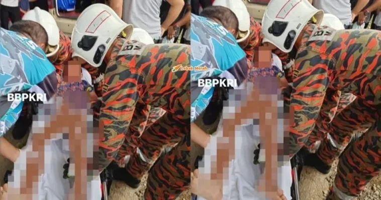 budak lelaki cedera pada perut tercucuk besi pengayuh basikal