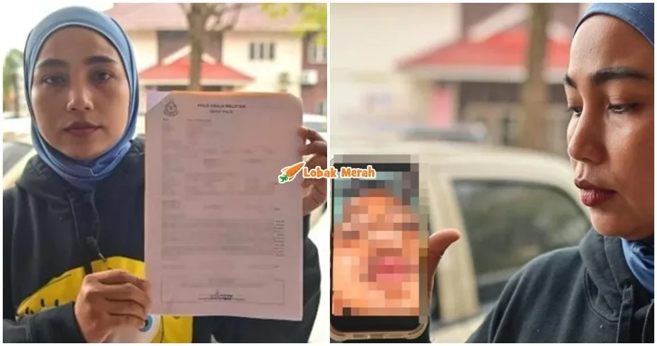 “Dia diserang sekumpulan murid” – Murid Tahun 2 P*tah Tulang Hidung Akibat Dip*kul Pelajar Lain