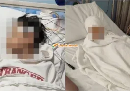 murid kanser hidung jadi mangsa buli