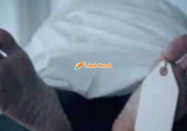 Pembedahan Kosmetik