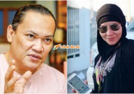 a. aida jantung berhenti 8 kali