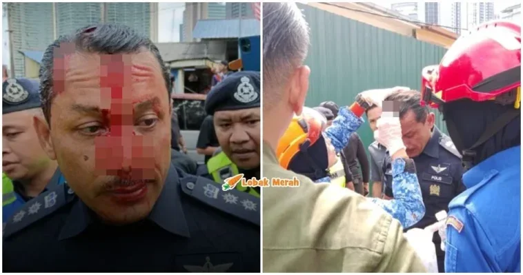 ft ketua polis dang wangi cedera