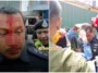 ft ketua polis dang wangi cedera