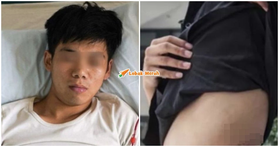 Pernah Tular Jual Buah Pinggang Demi iPhone 4, Lelaki Kini Berstatus OKU & Menderita Masalah Kesihatan