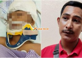kanak kanak cedera dipukul jantung terhenti 14 minit