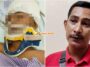 kanak kanak cedera dipukul jantung terhenti 14 minit