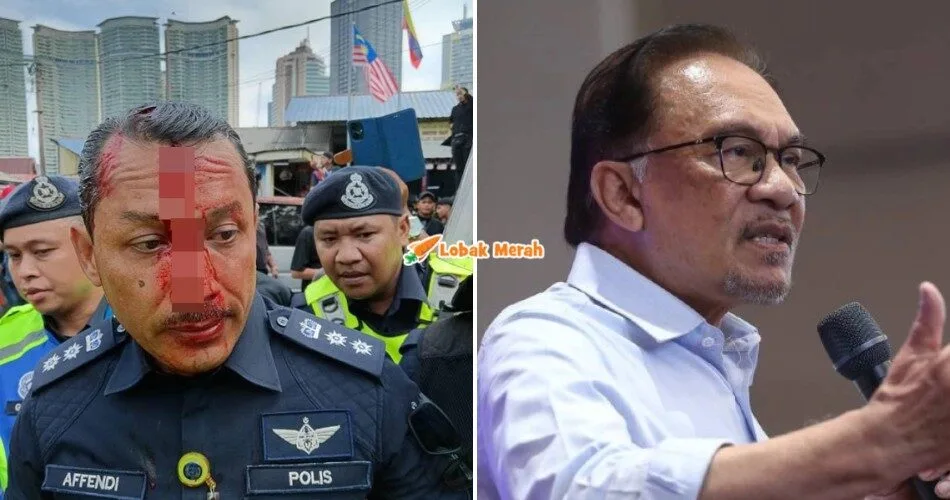 “Perbuatan keji” – PMX Beri Peringatan Susulan Insiden OCPD Dang Wangi Cedera Dibaling Batu