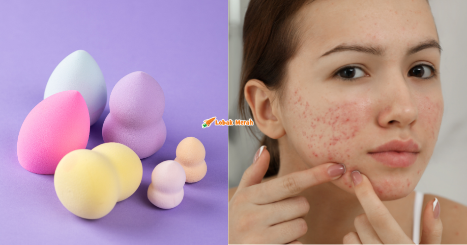 “Jijiknya!” – ‘Beauty Blender’ Antara Alat Solek Yang Wajib Dicuci, Ini 5 Sebab Kenapa Ia Penting