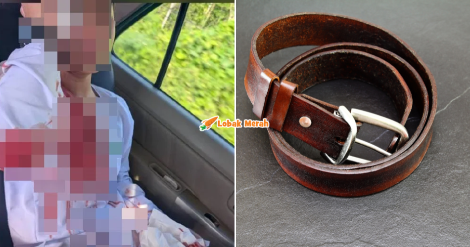 Tular Gambar Murid Perempuan Cedera Di Kepala, Rupanya Bukan Dip*kul Tapi Cedera Ketika Bermain
