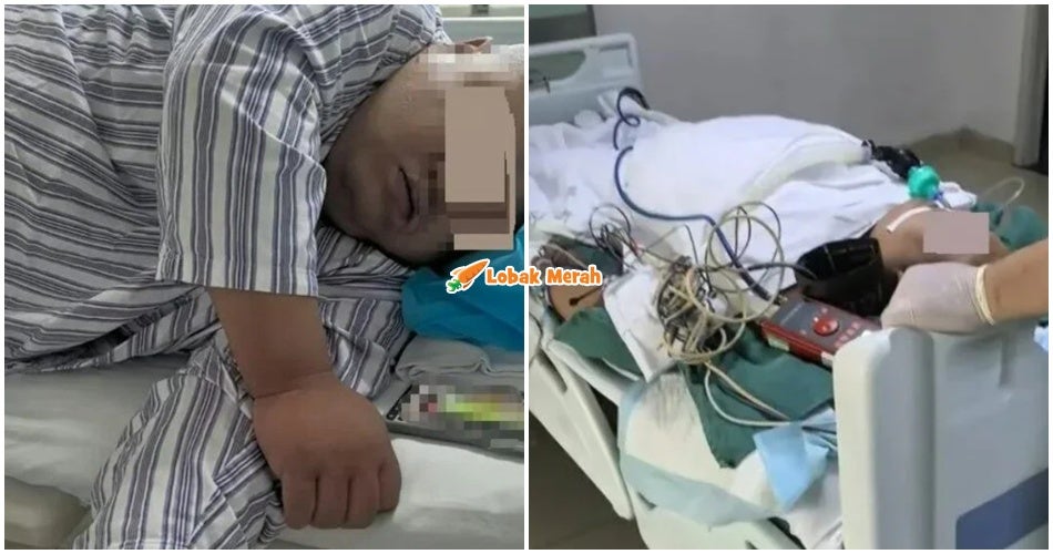 Gara-gara Nak ‘Impress’ Bakal Mentua, Lelaki Meninggal Dunia Jalani Pembedahan Pintasan Gastrik Sebab Nak Kuruskan Badan