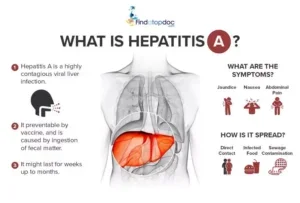 hepatitis A