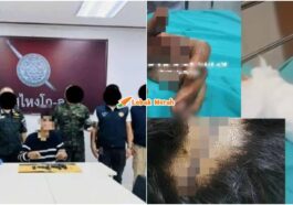 suspek tembak terima 120 jahitan