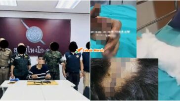 suspek tembak terima 120 jahitan