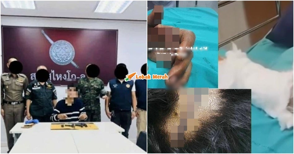 Polis Thailand Tak Tolak Kes T*mbak Di Sungai Golok Berkaitan Dendam Lama, Suspek Pernah Terima 120 Jahitan