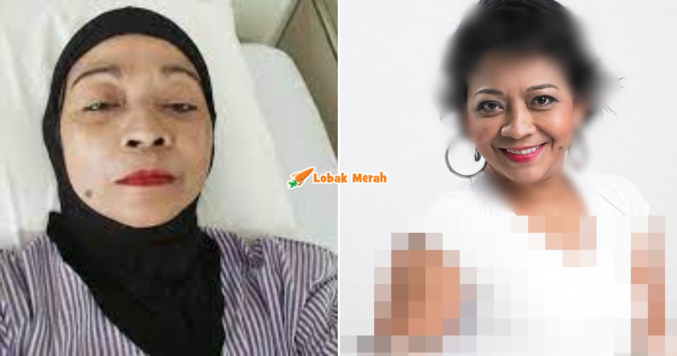 Bekas Peserta AF6, Mama Rina Hadapi Masalah Diabetes, Kaki Kanan Terpaksa Dip*tong