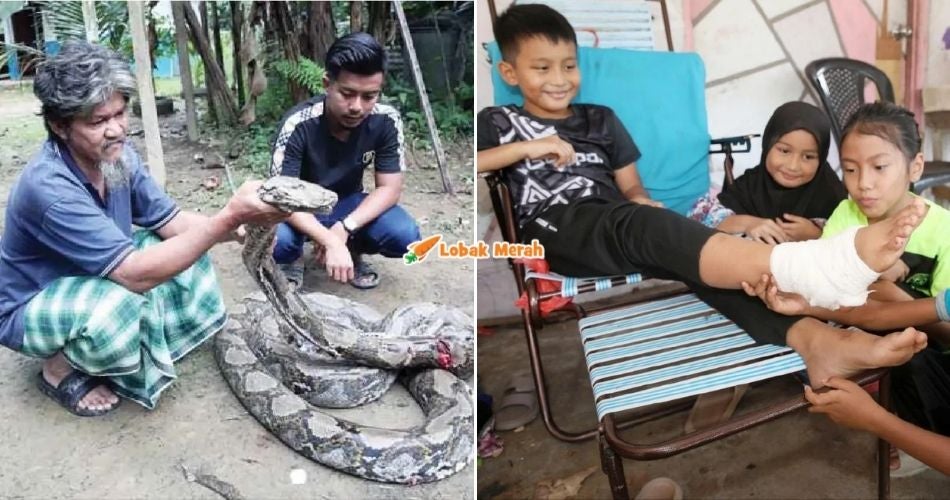 Ekor Hampir Masuk Dalam Hidung, Kanak-kanak 10 Tahun Kongsi Pengalaman Digigit & Dililit Ular